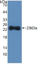 Polyclonal Antibody to Hydroxymethylglutaryl Coenzyme A Synthase (HMGCS)