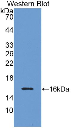 Polyclonal Antibody to Inhibin Beta B (INHbB)