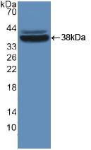 Polyclonal Antibody to Major Vault Protein (MVP)