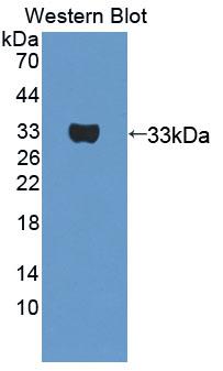 Polyclonal Antibody to Prostaglandin F2 Receptor Negative Regulator (PTGFRN)