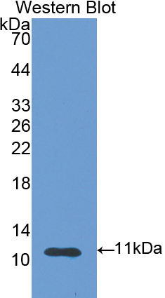 Polyclonal Antibody to S100 Calcium Binding Protein A6 (S100A6)