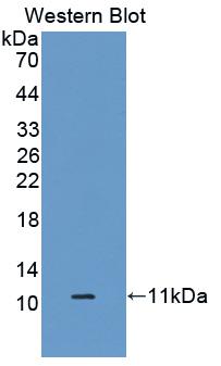 Polyclonal Antibody to S100 Calcium Binding Protein A6 (S100A6)