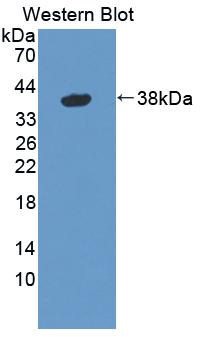 Polyclonal Antibody to Guanylate Binding Protein 4 (GBP4)