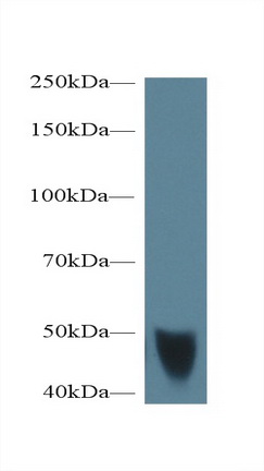 Polyclonal Antibody to Transglutaminase 1 (TGM1)