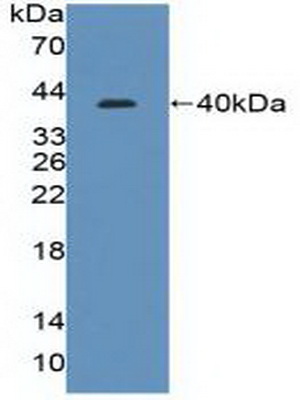 Polyclonal Antibody to Interferon Regulatory Factor 8 (IRF8)