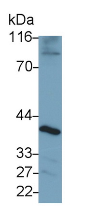 Polyclonal Antibody to Sialophorin (SPN)