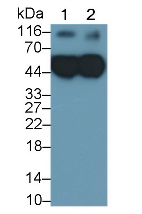 Polyclonal Antibody to Orosomucoid 2 (ORM2)