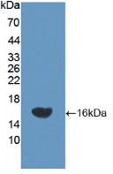 Polyclonal Antibody to Neprilysin (CD10)