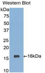 Polyclonal Antibody to Sialic Acid Binding Ig Like Lectin 7 (SIGLEC7)