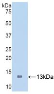 Polyclonal Antibody to S100 Calcium Binding Protein A8 (S100A8)