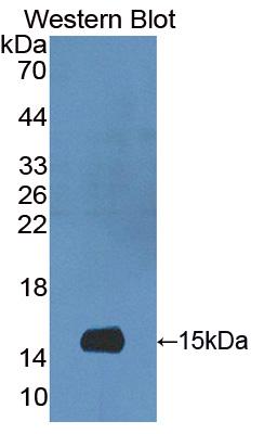 Polyclonal Antibody to S100 Calcium Binding Protein A9 (S100A9)