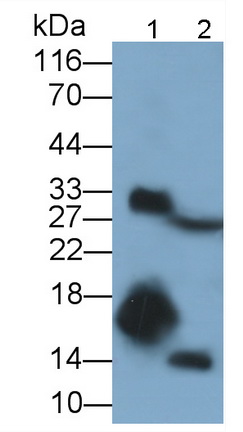 Polyclonal Antibody to S100 Calcium Binding Protein A9 (S100A9)