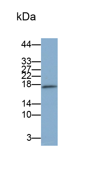 Polyclonal Antibody to S100 Calcium Binding Protein A9 (S100A9)