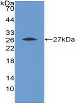 Polyclonal Antibody to Fibroblast Growth Factor Receptor 4 (FGFR4)