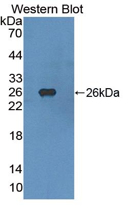 Polyclonal Antibody to Fibroblast Growth Factor Receptor 4 (FGFR4)