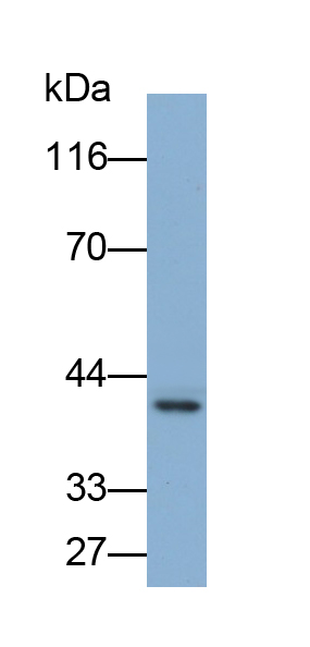 Polyclonal Antibody to Natural Cytotoxicity Triggering Receptor 1 (NCR1)