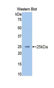 Polyclonal Antibody to High Molecular Weight Kininogen (HMWK)