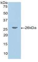 Polyclonal Antibody to Jagged 1 (JAG1)