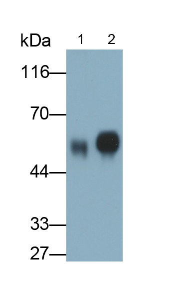 Polyclonal Antibody to Vitamin D Binding Protein (DBP)