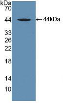 Polyclonal Antibody to Vitamin D Binding Protein (DBP)