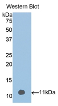 Polyclonal Antibody to Vitamin D Binding Protein (DBP)