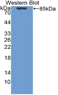 Polyclonal Antibody to Vitamin D Binding Protein (DBP)