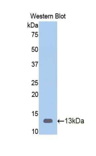 Polyclonal Antibody to Vitamin D Binding Protein (DBP)