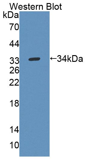 Polyclonal Antibody to Uridine Phosphorylase 1 (UPP1)