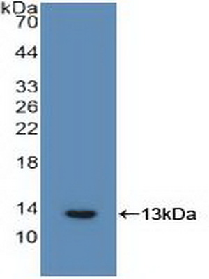 Polyclonal Antibody to Interleukin 6 Receptor (IL6R)