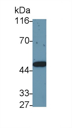 Polyclonal Antibody to Interleukin 6 Receptor (IL6R)