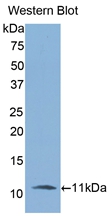 Polyclonal Antibody to Interleukin 6 Receptor (IL6R)