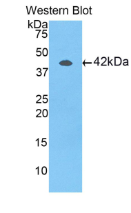 Polyclonal Antibody to Vascular Endothelial Growth Factor Receptor 1 (VEGFR1)