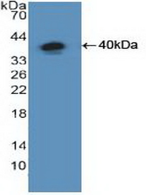 Polyclonal Antibody to Nuclear Factor Kappa B (NFkB)