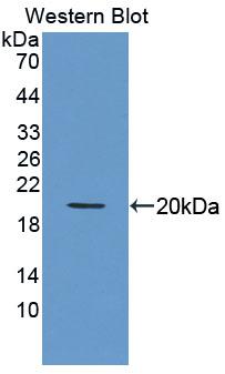 Polyclonal Antibody to Hedgehog Homolog, Sonic (SHH)