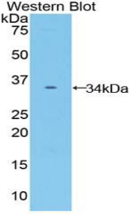 Polyclonal Antibody to Frizzled Homolog 10 (FZD10)