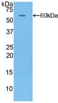 Polyclonal Antibody to Complement Factor D (CFD)