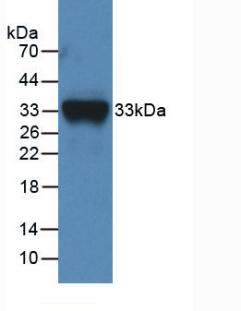 Polyclonal Antibody to Coagulation Factor XI (F11)