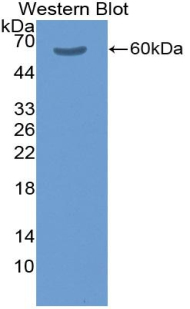 Polyclonal Antibody to Coagulation Factor XI (F11)