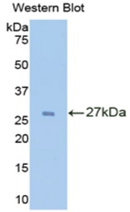 Polyclonal Antibody to Interleukin 2 Receptor Alpha (IL2Ra)