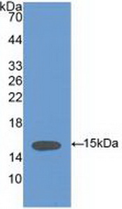 Polyclonal Antibody to Vinculin (VCL)