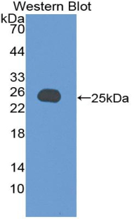 Polyclonal Antibody to Vinculin (VCL)