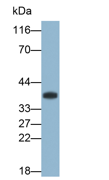 Polyclonal Antibody to Inhibitory Subunit Of NF Kappa B Alpha (IkBa)