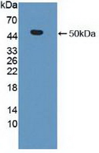 Polyclonal Antibody to Matrix Metalloproteinase 19 (MMP19)