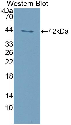 Polyclonal Antibody to Choline Transporter Like Protein 1 (CTL1)