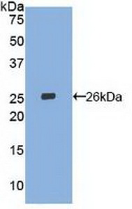 Polyclonal Antibody to Lectin Like Oxidized Low Density Lipoprotein Receptor 1 (LOX1)