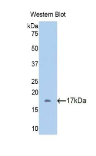 Polyclonal Antibody to Fetuin B (FETUB)