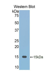 Polyclonal Antibody to Fetuin B (FETUB)