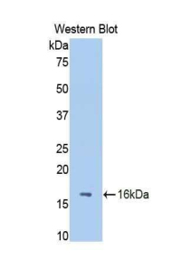 Polyclonal Antibody to Fetuin B (FETUB)