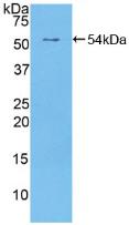 Polyclonal Antibody to Receptor Tyrosine Protein Kinase erbB-2 (ErbB2)