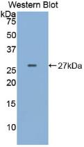 Polyclonal Antibody to Receptor Tyrosine Protein Kinase erbB-2 (ErbB2)